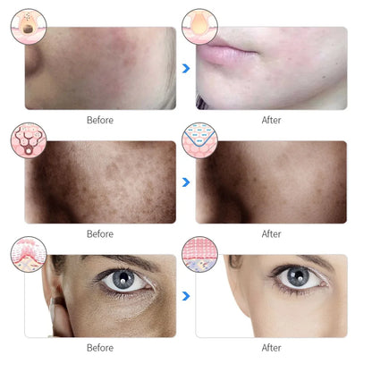 Rechargeable 7 Color LED Facial Mask – Photon Light Therapy Beauty Mask for Home Skincare - Vellévia