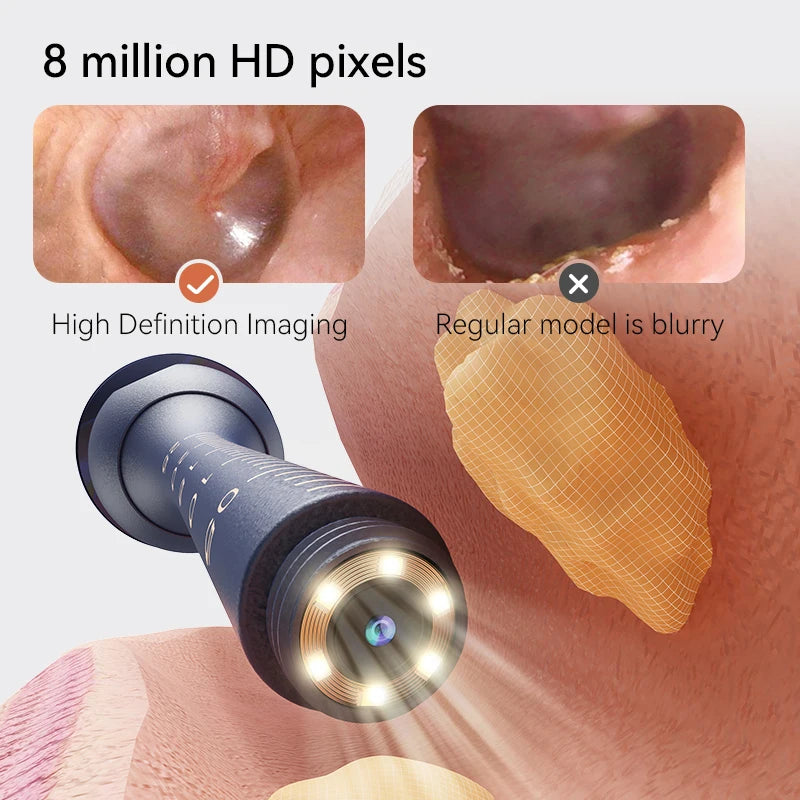 Wireless Ear Wax Removal Tool with 1080P Camera – Waterproof Visual Ear Cleaner Kit with Tweezers - Vellévia